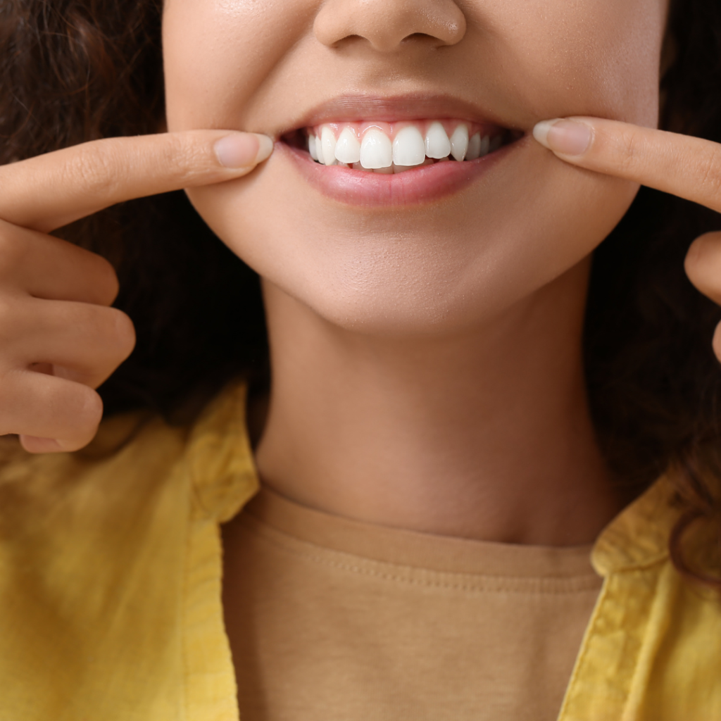 After Getting Permanent Crowns - Uptown Dental Lab